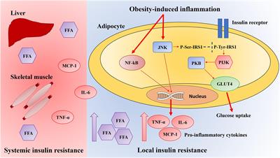 Insulin resistance and inflammation